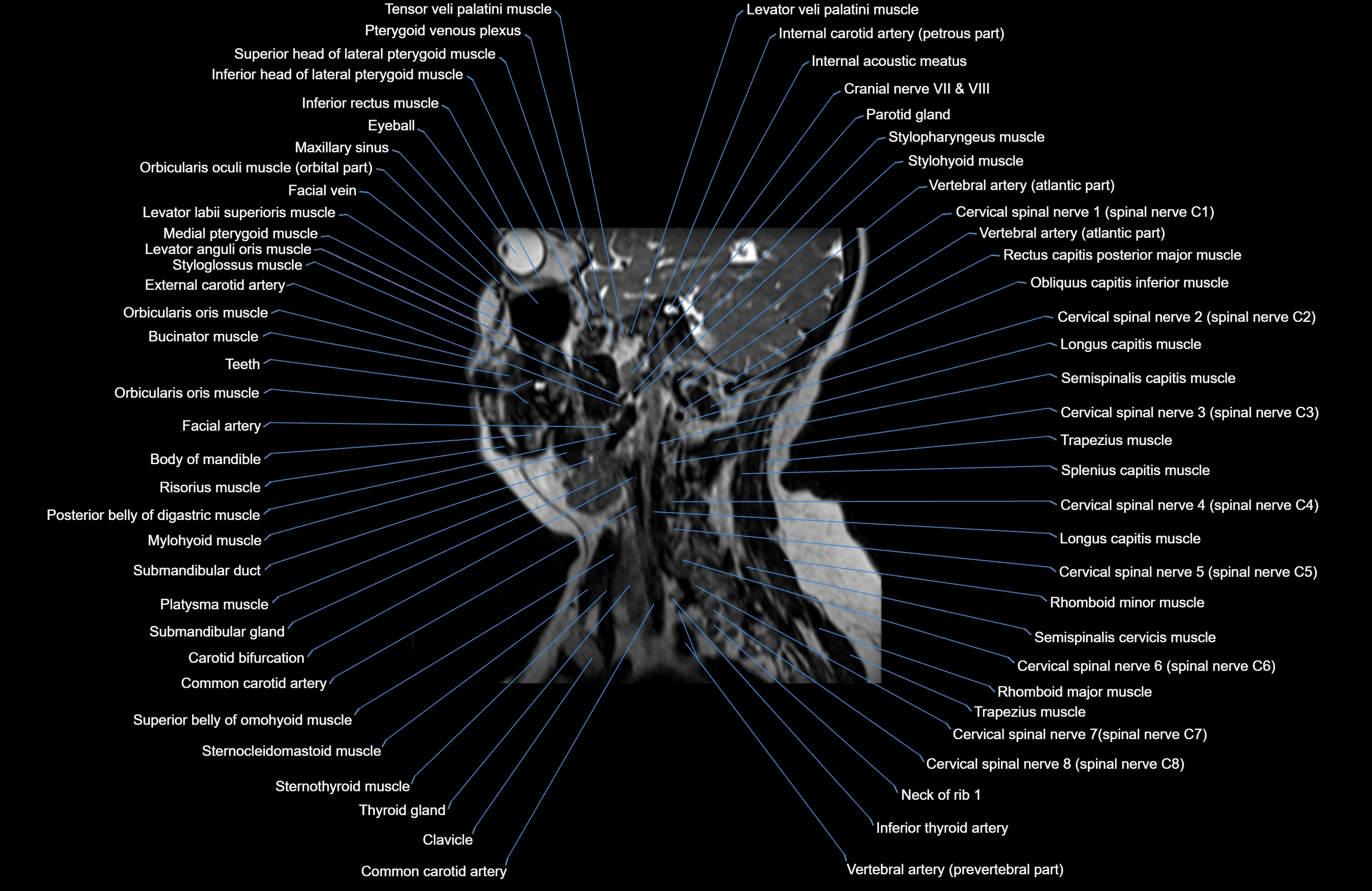 Neck MRI sagittal cross sectional anatomy 3D 1mm 3T radiology  image-img-00001-00018.webp